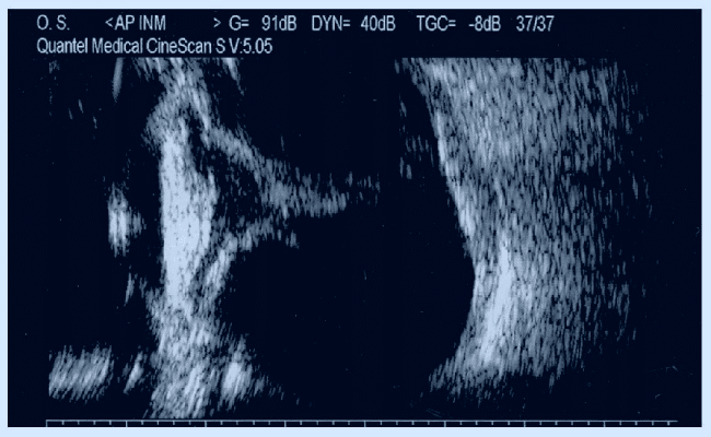 ramas de la coreografía