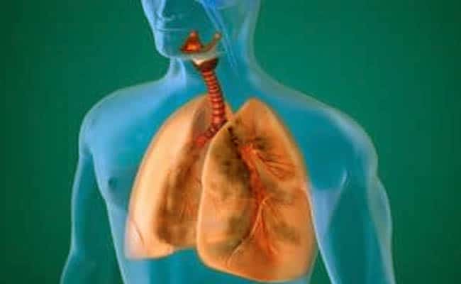 que es la neumatocele